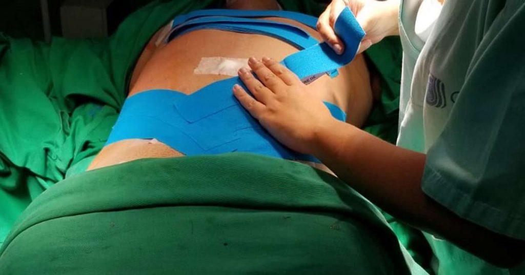 Acompanhamento pós-operatório e Cirurgia Plástica