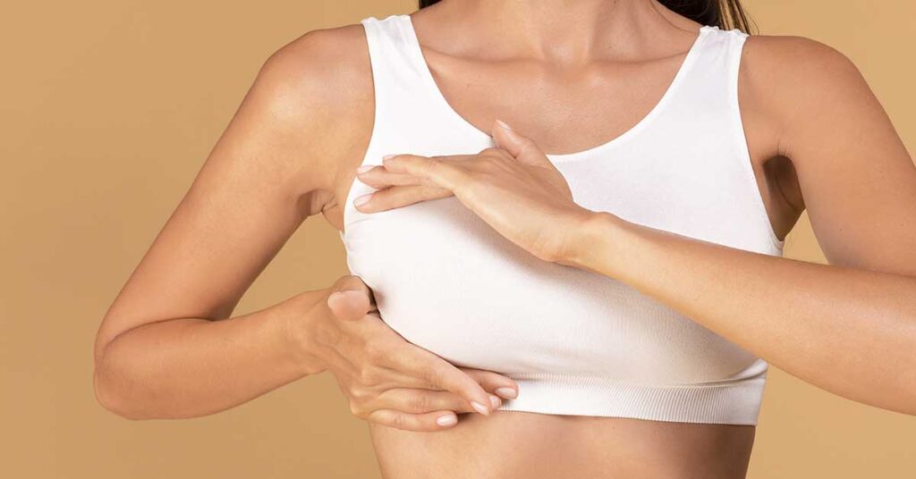 Como manter os Resultados da Mamoplastia a longo prazo?